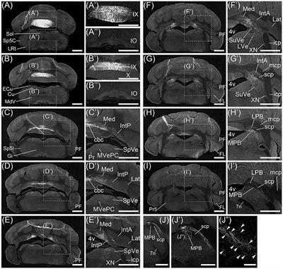 Anatomical Evidence for a Direct Projection from Purkinje Cells in the Mouse Cerebellar Vermis to Medial Parabrachial Nucleus